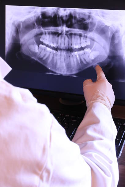 Best Emergency Dental Care for Abscessed Tooth in Weston, WV