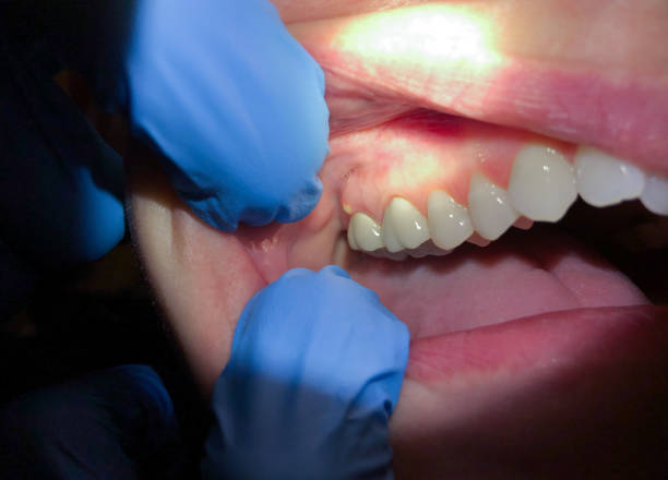 Best Orthodontic Emergency Dentist in Weston, WV